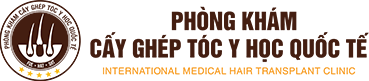 cấy ghép tóc