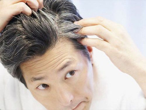 CẤY TÓC CÓ LÀM TÓC BỊ BẠC NHANH HƠN KHÔNG