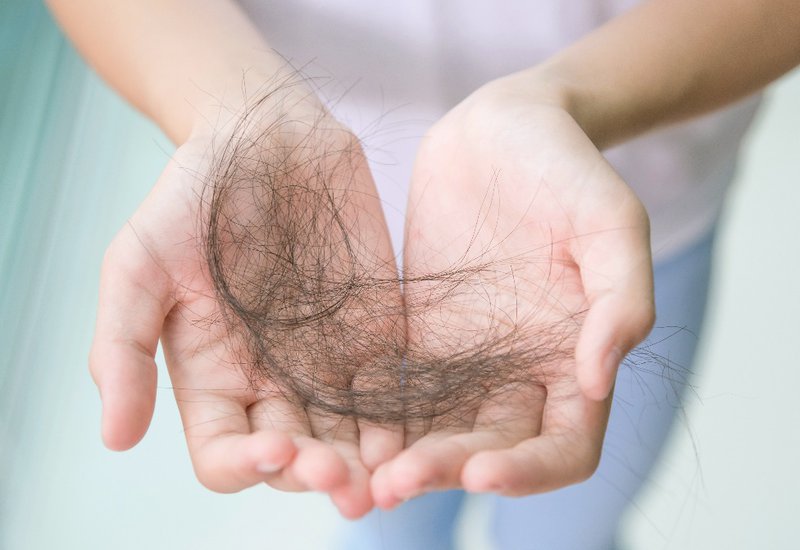 RỤNG TÓC THAY THÂN SAU KHI CẤY TÓC CÓ ĐÁNG LO?